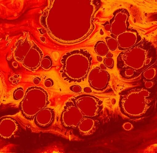 Old muscle stem cells can act young again but there’s a catch – ScienceDaily