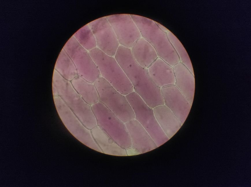 Old muscle stem cells can act young again but there’s a catch - ScienceDaily